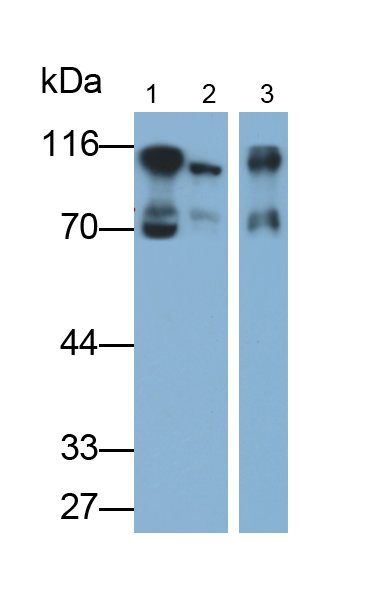 Monoclonal Antibody to Complement Factor B (CFB)