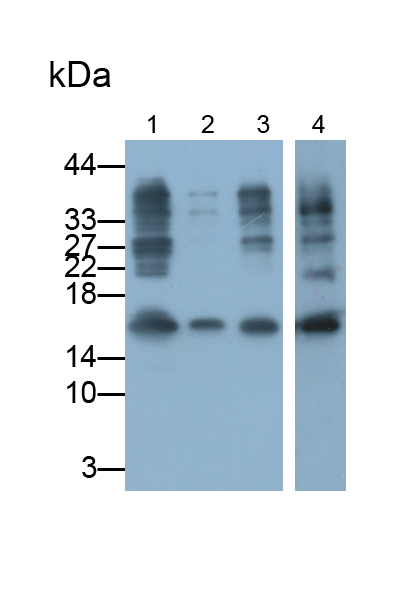 Monoclonal Antibody to S100 Calcium Binding Protein A5 (S100A5)