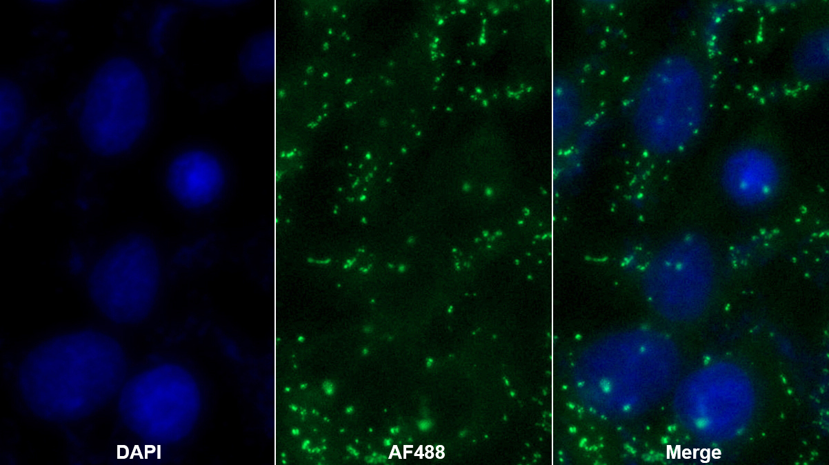 Monoclonal Antibody to Glucose Transporter 4 (GLUT4)