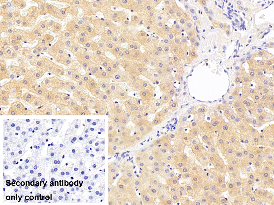 Monoclonal Antibody to Aldehyde Dehydrogenase, Mitochondrial (ALDH2)