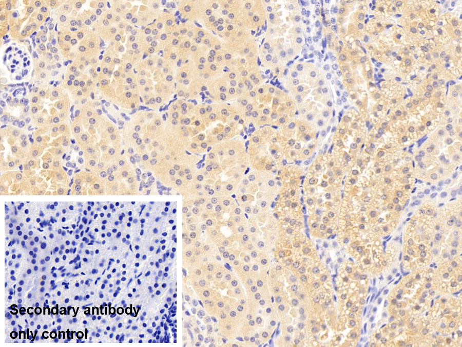 Monoclonal Antibody to Aldehyde Dehydrogenase, Mitochondrial (ALDH2)