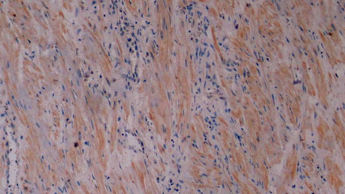 Monoclonal Antibody to Cytokeratin 8 (CK8)