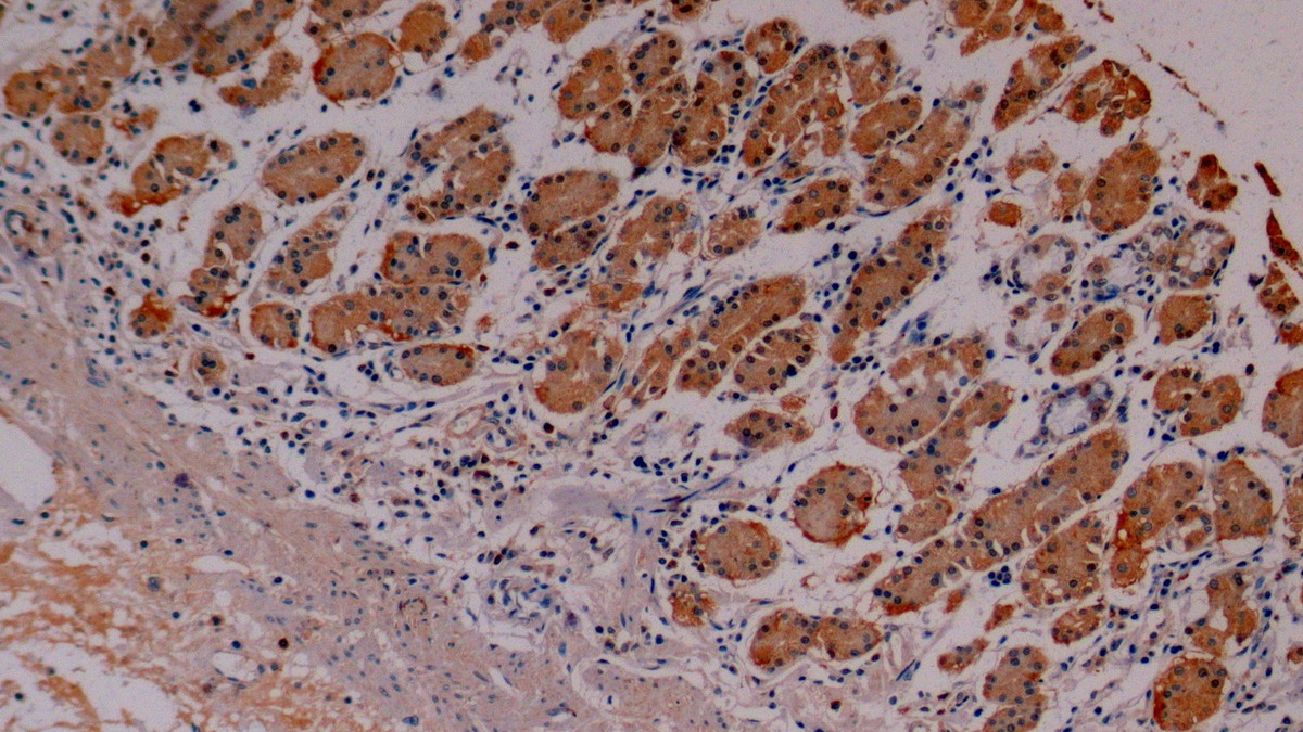 Monoclonal Antibody to Cytokeratin 8 (CK8)