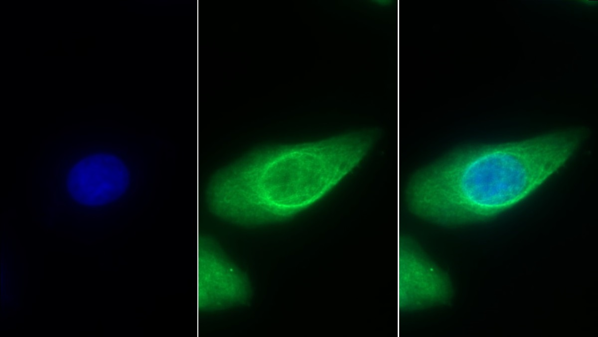 Monoclonal Antibody to Cytokeratin 8 (CK8)