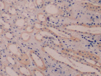 Monoclonal Antibody to Cytokeratin 8 (CK8)