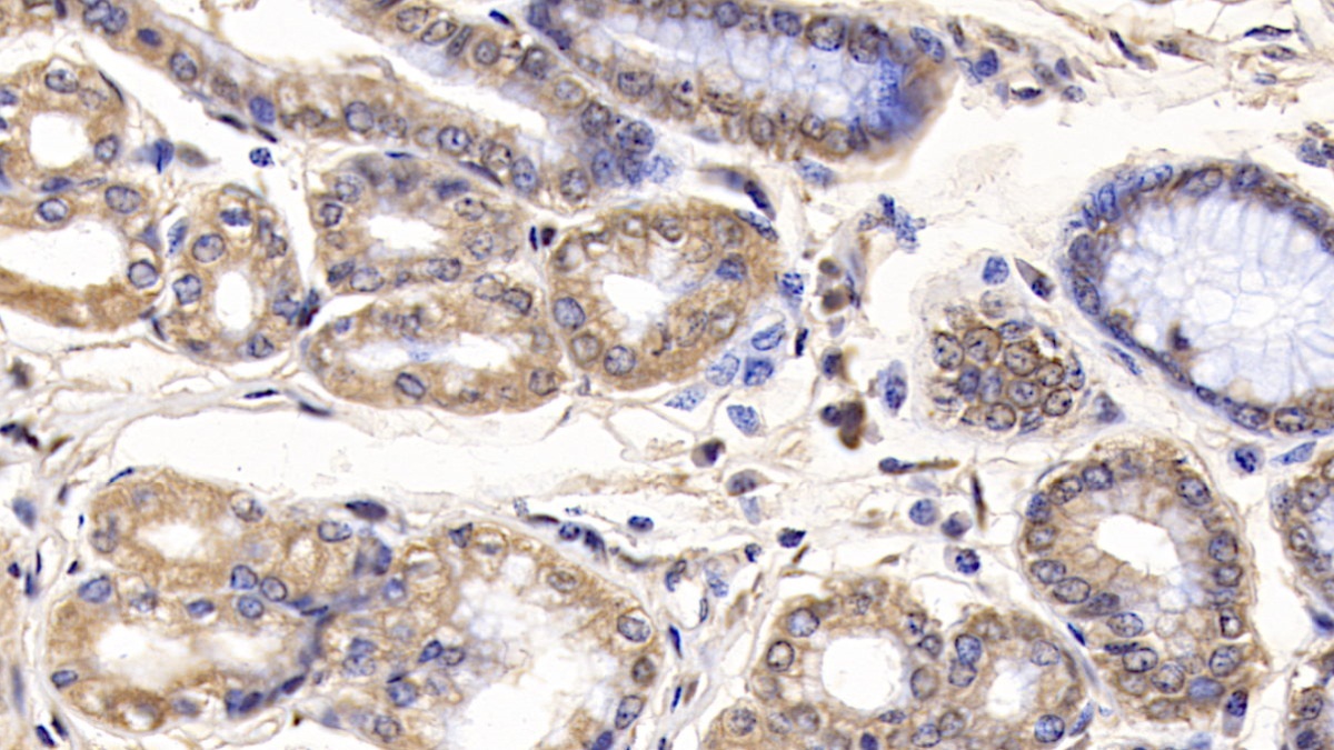 Monoclonal Antibody to Interleukin 29 (IL29)