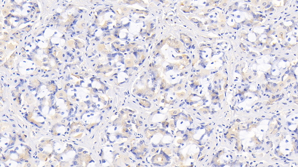 Monoclonal Antibody to Interleukin 29 (IL29)