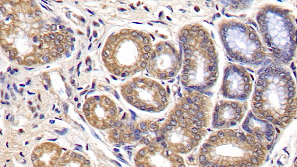 Monoclonal Antibody to Interleukin 29 (IL29)