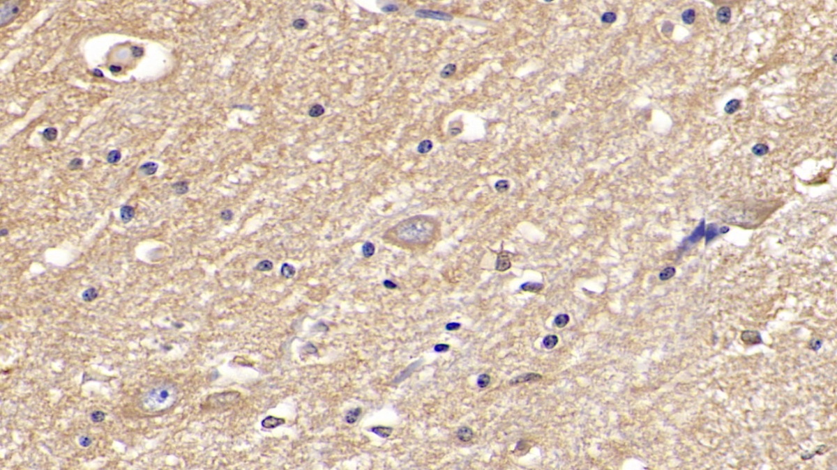 Monoclonal Antibody to Interleukin 29 (IL29)