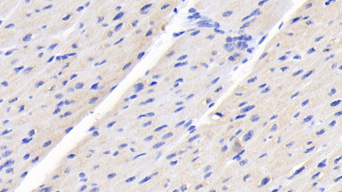 Monoclonal Antibody to Creatine Kinase B (CK-BB)