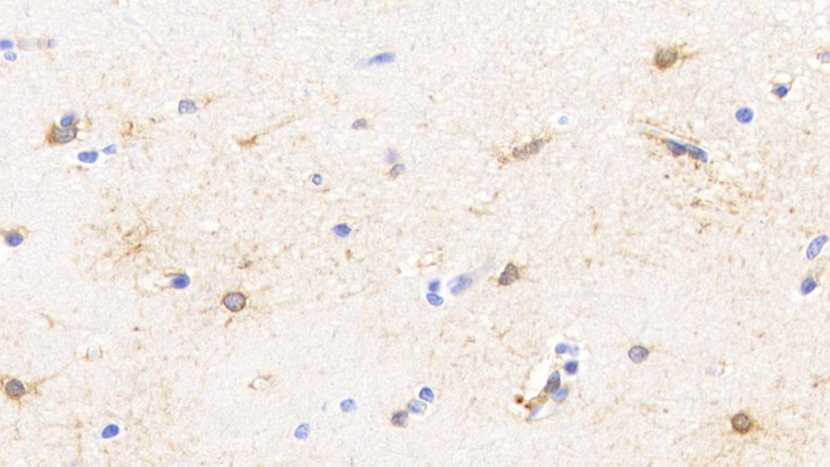 Monoclonal Antibody to Creatine Kinase B (CK-BB)