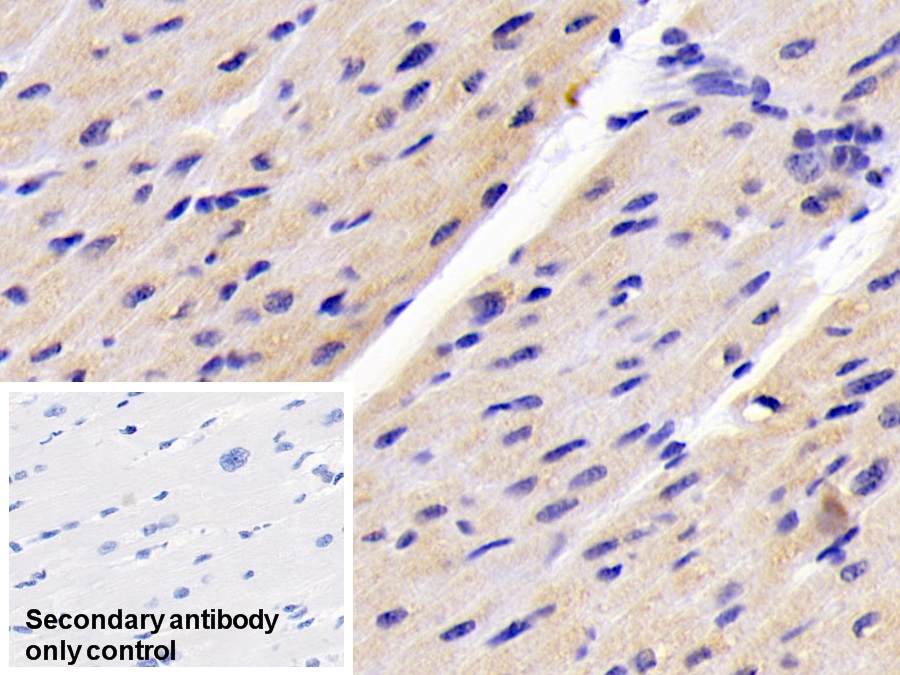 Monoclonal Antibody to Creatine Kinase B (CK-BB)