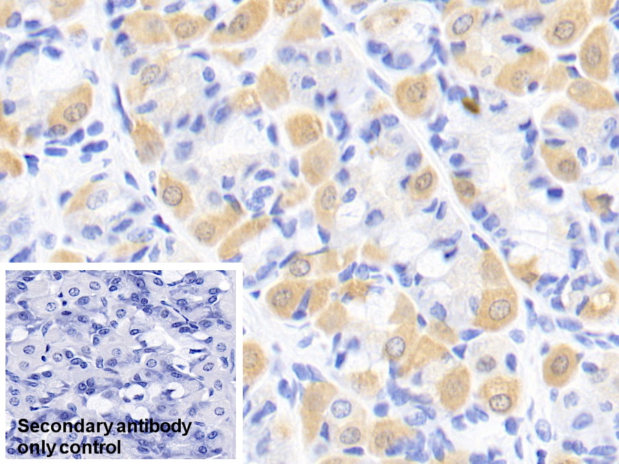 Monoclonal Antibody to Creatine Kinase B (CK-BB)