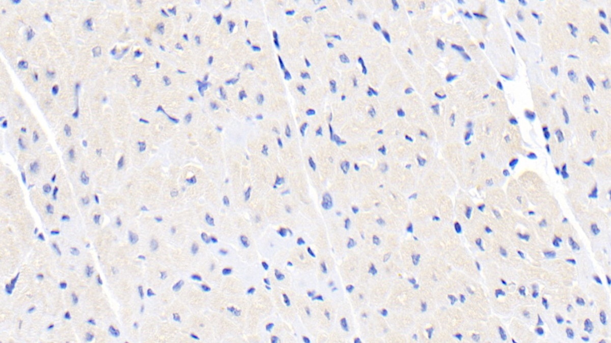 Monoclonal Antibody to Creatine Kinase B (CK-BB)