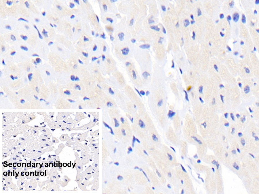 Monoclonal Antibody to Creatine Kinase B (CK-BB)