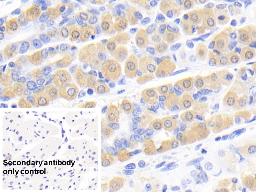 Monoclonal Antibody to Creatine Kinase B (CK-BB)