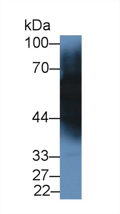 Monoclonal Antibody to Transferrin (TF)