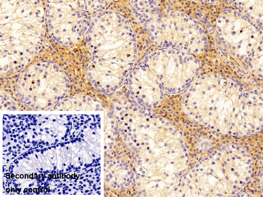 Monoclonal Antibody to Transferrin (TF)