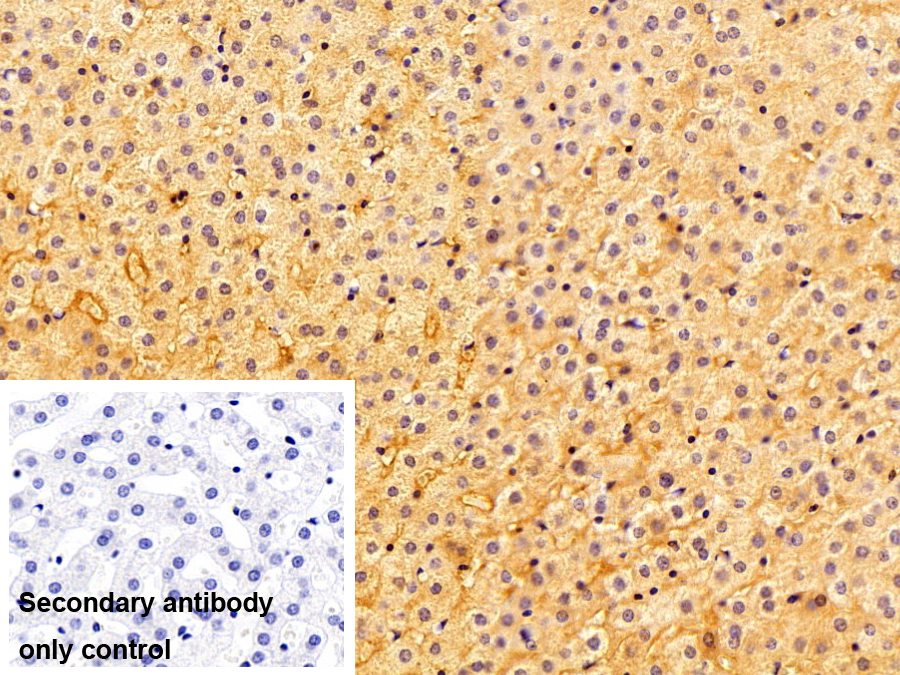 Monoclonal Antibody to Transferrin (TF)