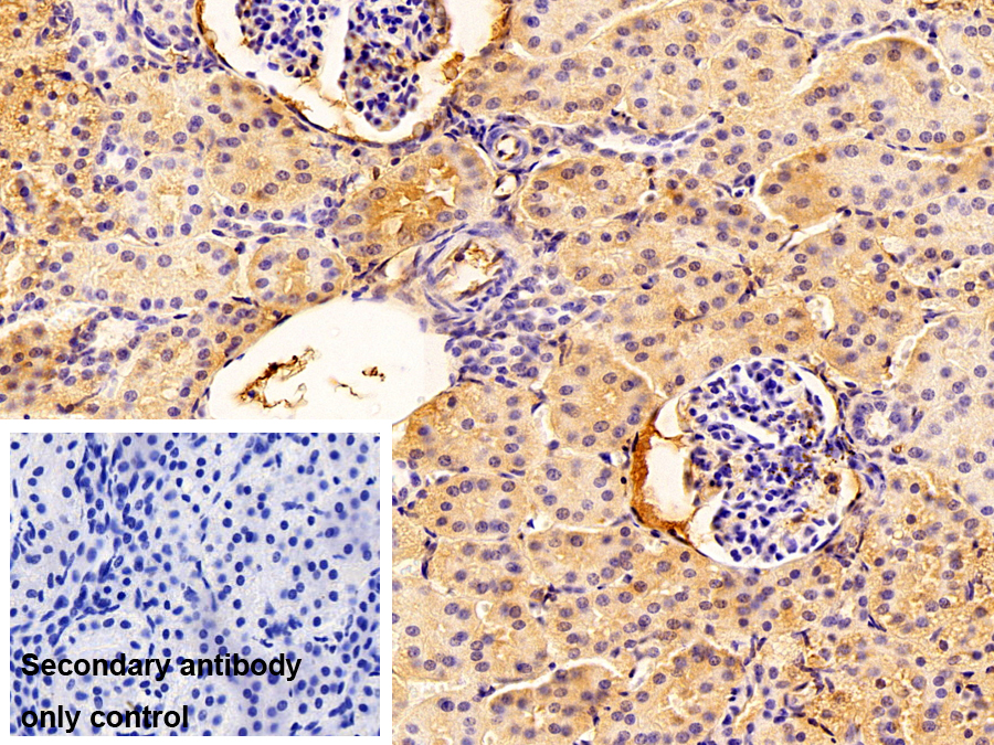 Monoclonal Antibody to Transferrin (TF)