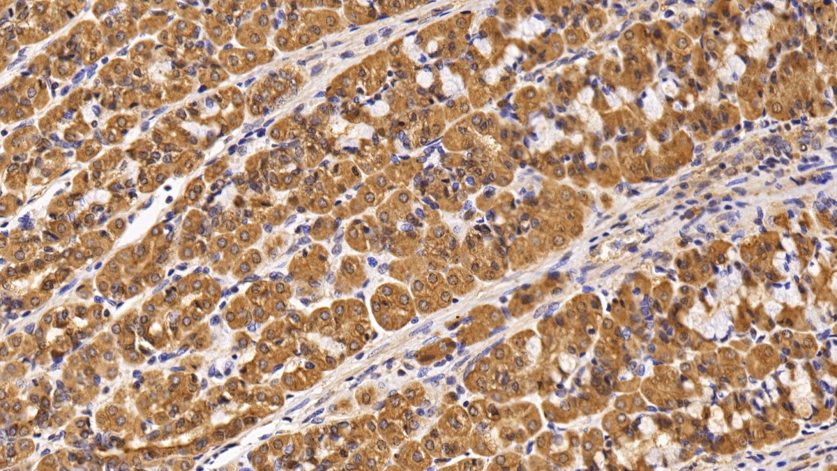 Monoclonal Antibody to Survivin (Surv)