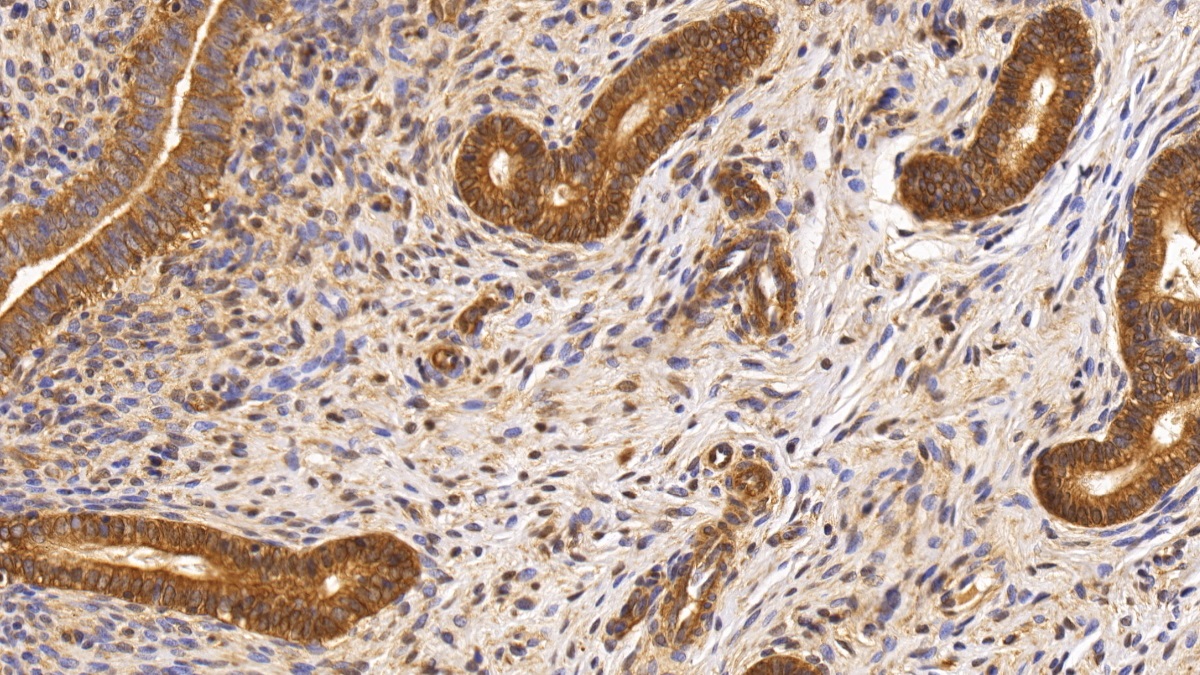 Monoclonal Antibody to Survivin (Surv)