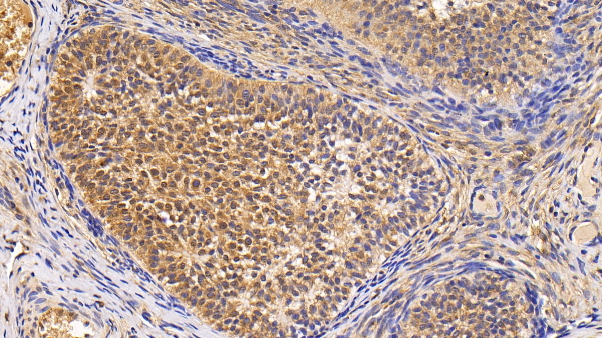 Monoclonal Antibody to Survivin (Surv)