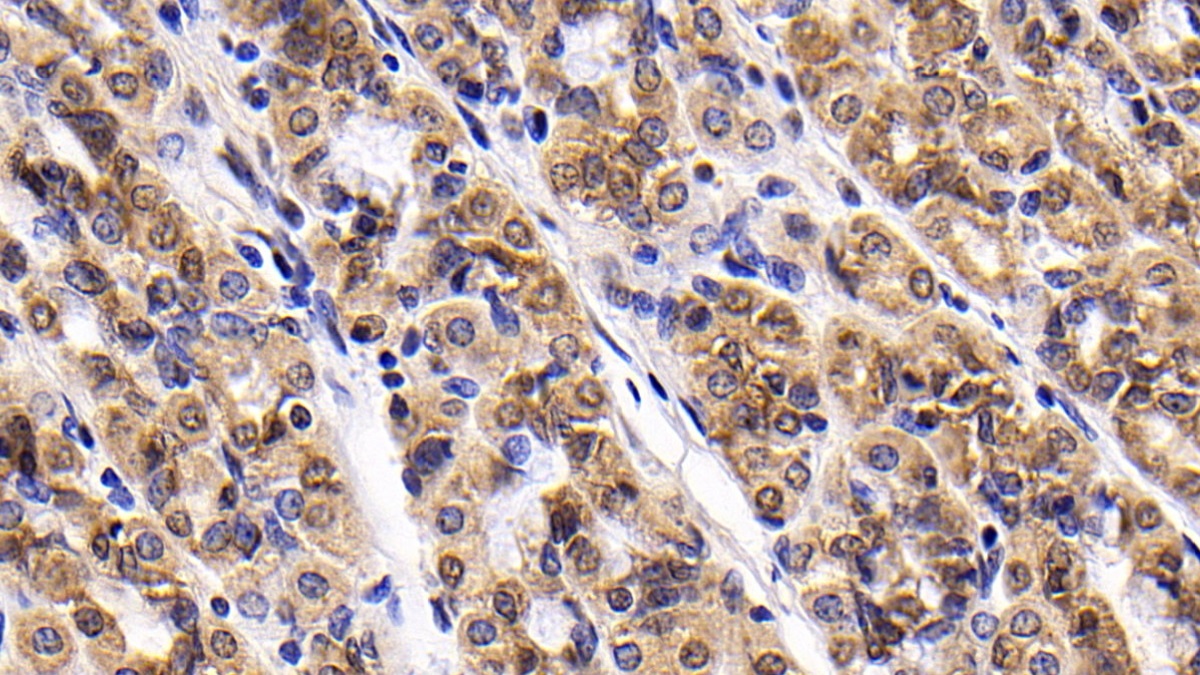 Monoclonal Antibody to Survivin (Surv)