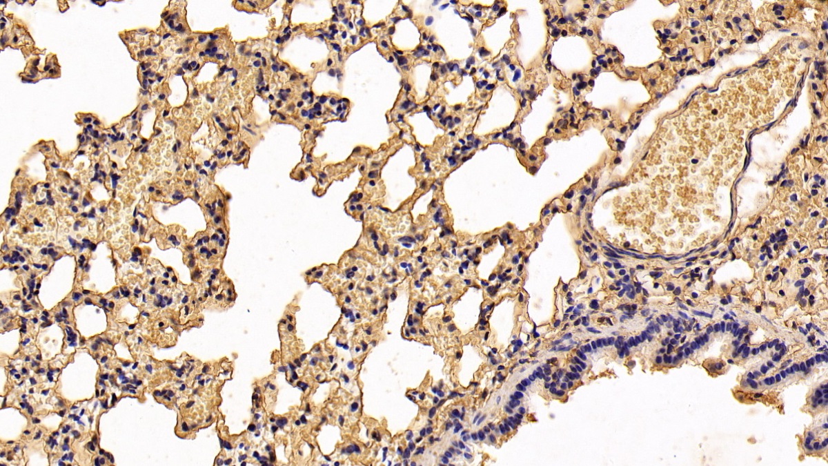 Monoclonal Antibody to S100 Calcium Binding Protein A10 (S100A10)