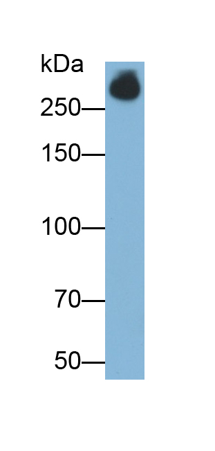 Monoclonal Antibody to Ki-67 Protein (Ki-67)