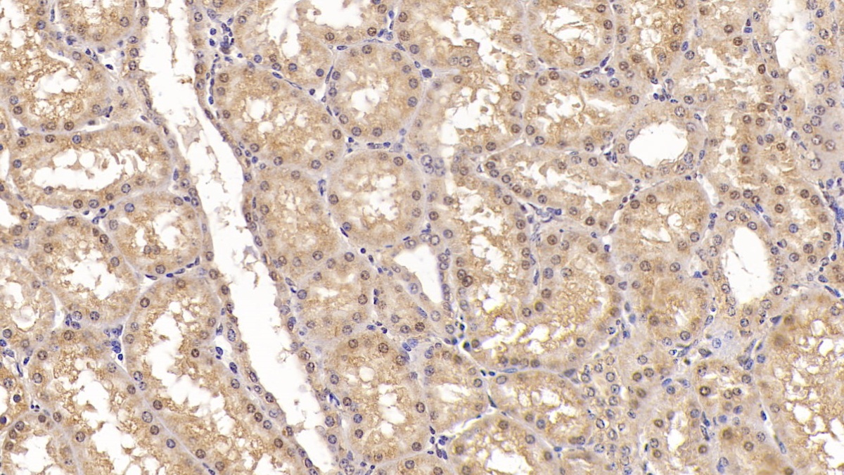 Monoclonal Antibody to Activin A Receptor Type II A (ACVR2A)