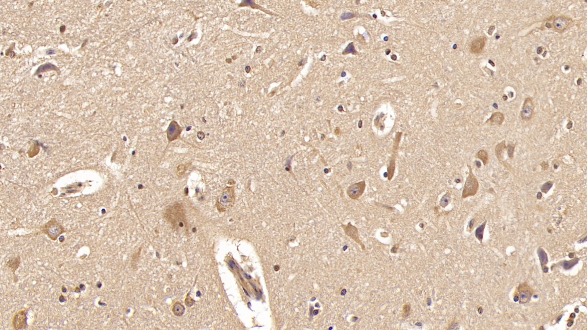 Monoclonal Antibody to Activin A Receptor Type II A (ACVR2A)