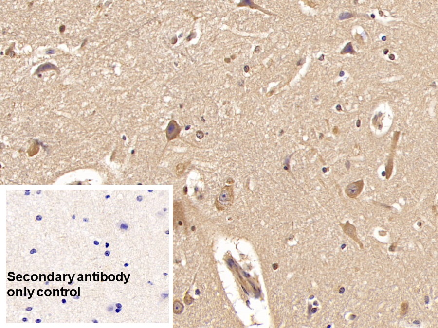 Monoclonal Antibody to Activin A Receptor Type II A (ACVR2A)