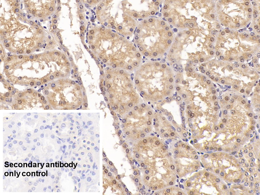 Monoclonal Antibody to Activin A Receptor Type II A (ACVR2A)