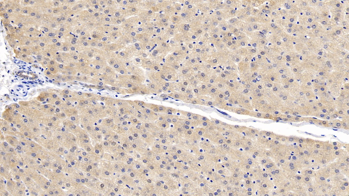 Monoclonal Antibody to SMAD family member 3 (SMAD3)