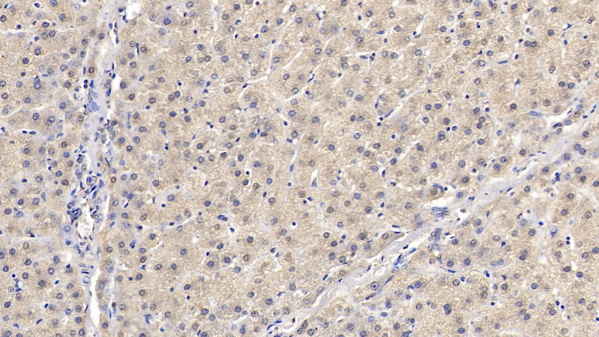 Monoclonal Antibody to SMAD family member 3 (SMAD3)