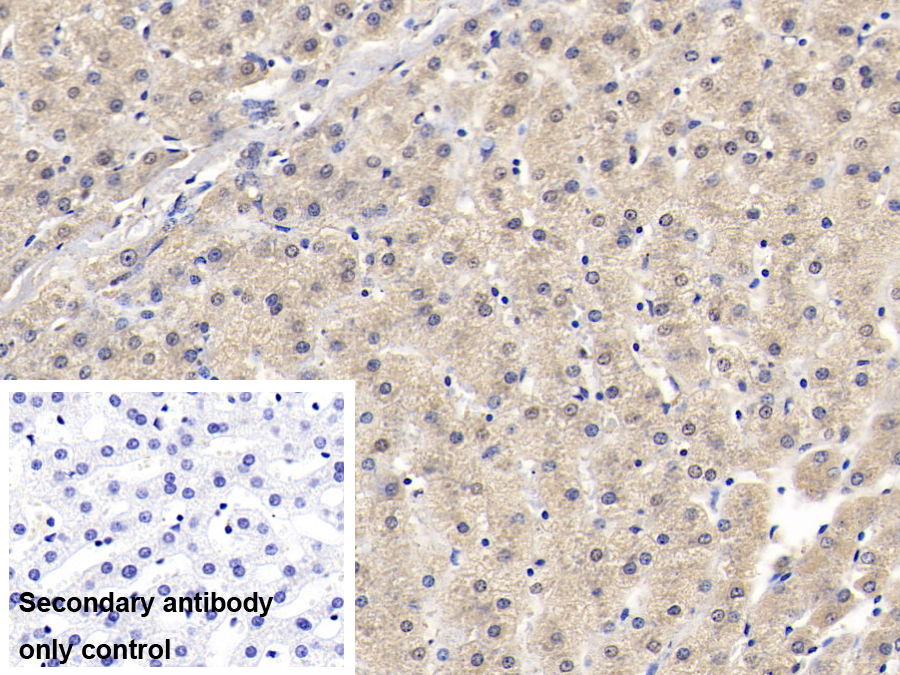 Monoclonal Antibody to SMAD family member 3 (SMAD3)