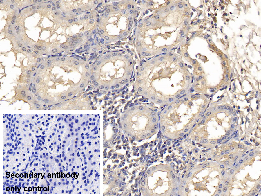 Monoclonal Antibody to SMAD family member 3 (SMAD3)