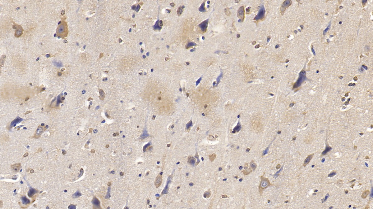 Monoclonal Antibody to SMAD family member 3 (SMAD3)