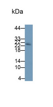 Monoclonal Antibody to Noggin (NOG)