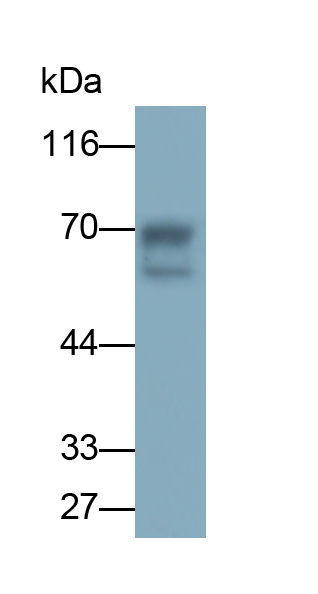Monoclonal Antibody to Collagen Type VIII Alpha 1 (COL8a1)
