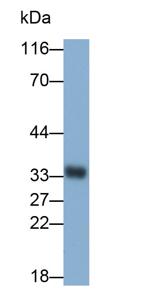 Monoclonal Antibody to HLA Class II Histocompatibility Antigen, DR Alpha Chain (HLA-DRA)