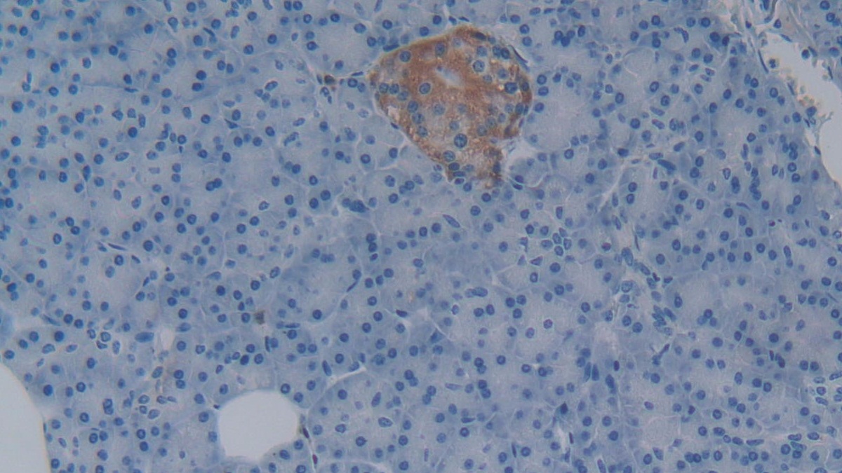 Monoclonal Antibody to Left/Right Determination Factor 1 (LEFTY1)