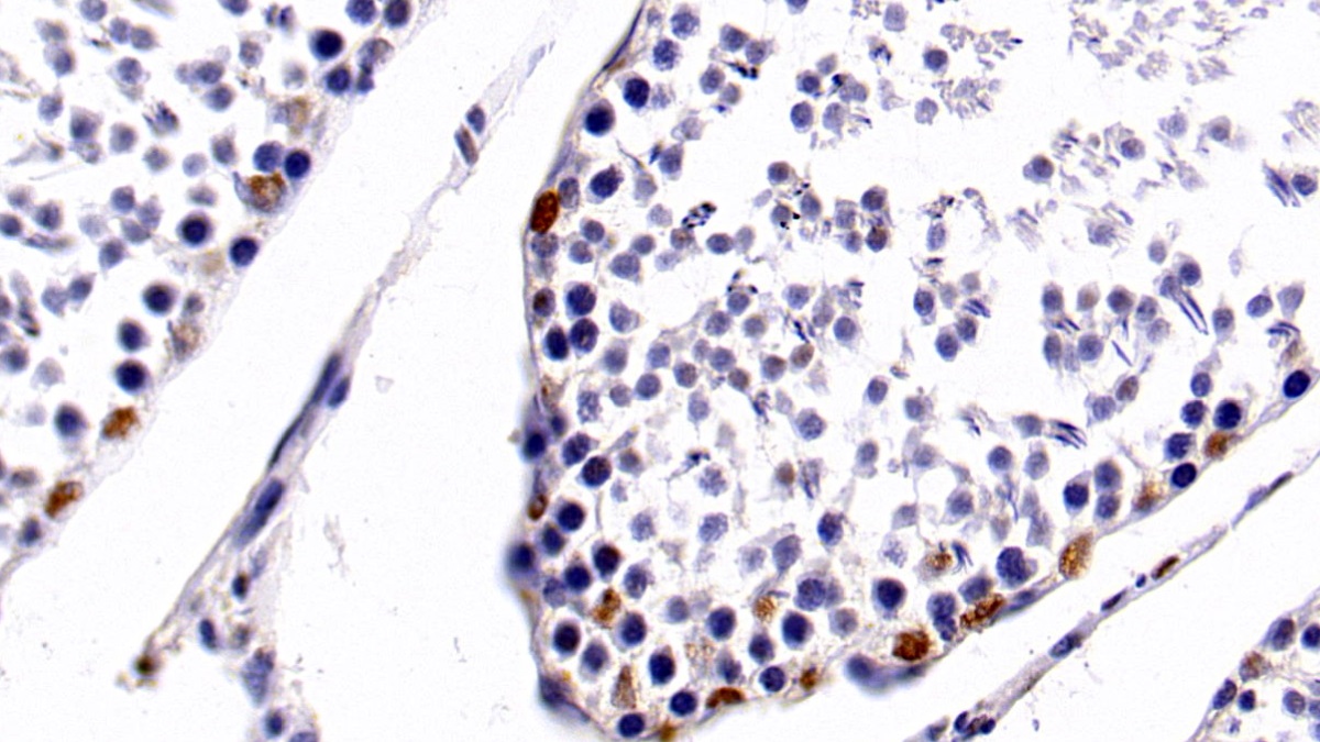 Monoclonal Antibody to Histone Deacetylase 1 (HDAC1)