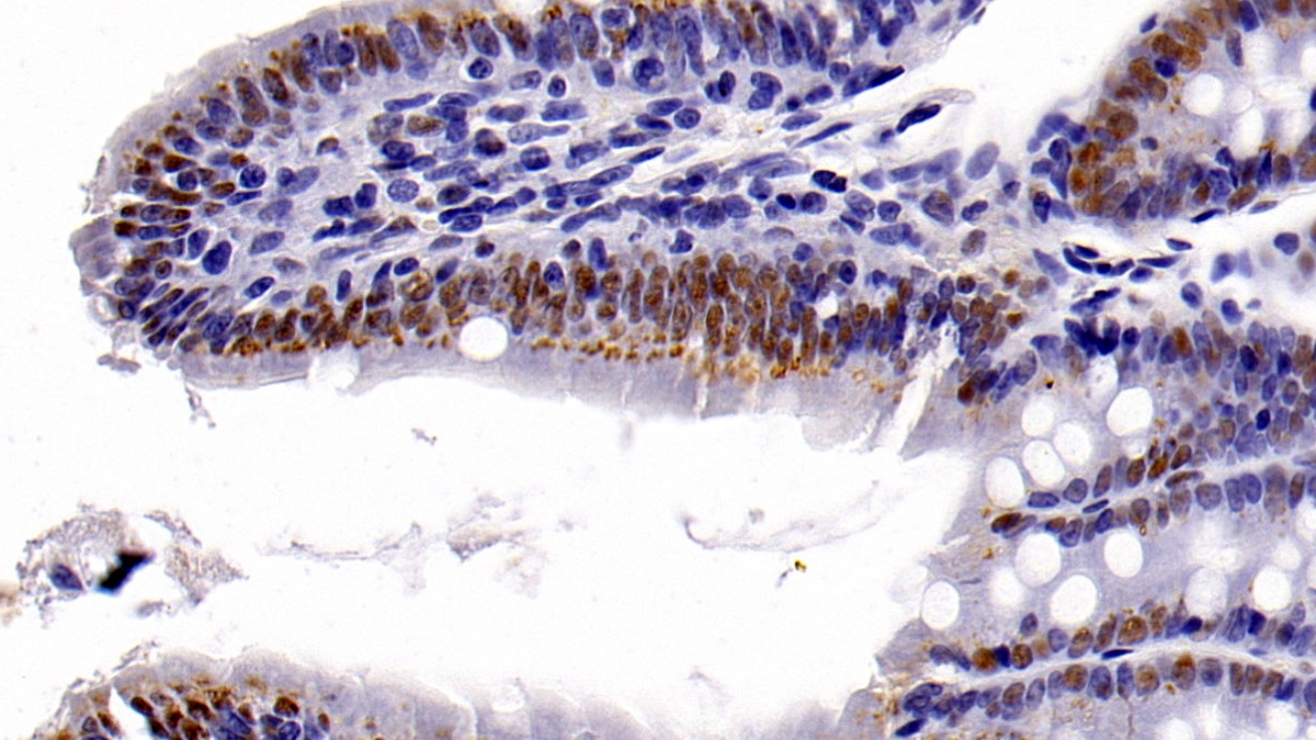 Monoclonal Antibody to Histone Deacetylase 1 (HDAC1)