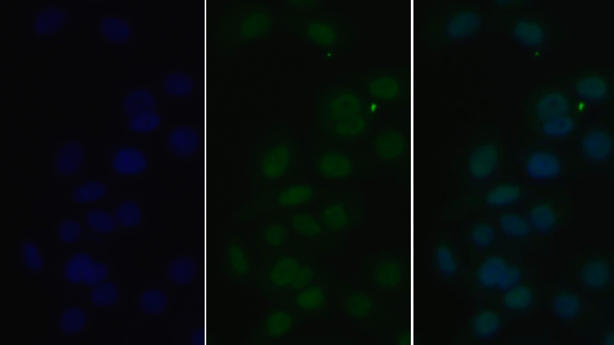 Monoclonal Antibody to Histone Deacetylase 1 (HDAC1)