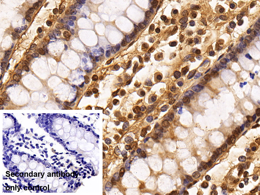 Monoclonal Antibody to Histone Deacetylase 1 (HDAC1)