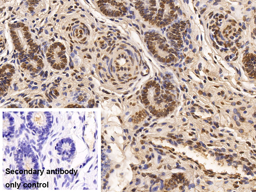 Monoclonal Antibody to Histone Deacetylase 1 (HDAC1)