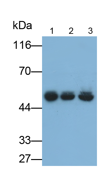 Monoclonal Antibody to Bleomycin Hydrolase (BLMH)