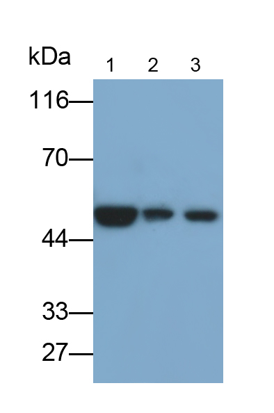 Monoclonal Antibody to Bleomycin Hydrolase (BLMH)